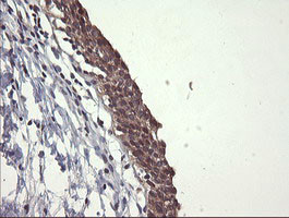 UBE2G2 Antibody in Immunohistochemistry (Paraffin) (IHC (P))