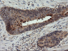 UBE2G2 Antibody in Immunohistochemistry (Paraffin) (IHC (P))