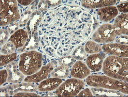 UBE2G2 Antibody in Immunohistochemistry (Paraffin) (IHC (P))