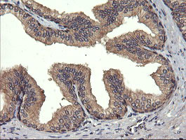 UBE2G2 Antibody in Immunohistochemistry (Paraffin) (IHC (P))