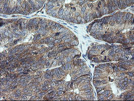 UBE2G2 Antibody in Immunohistochemistry (Paraffin) (IHC (P))