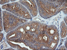 UBE2G2 Antibody in Immunohistochemistry (Paraffin) (IHC (P))