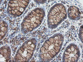 UBE2G2 Antibody in Immunohistochemistry (Paraffin) (IHC (P))