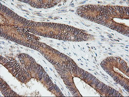 UBE2G2 Antibody in Immunohistochemistry (Paraffin) (IHC (P))