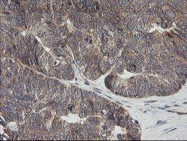 UBE2G2 Antibody in Immunohistochemistry (Paraffin) (IHC (P))