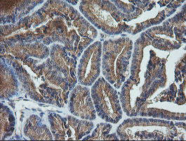 UBE2G2 Antibody in Immunohistochemistry (Paraffin) (IHC (P))