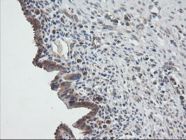 UBE2G2 Antibody in Immunohistochemistry (Paraffin) (IHC (P))