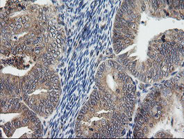 UBE2G2 Antibody in Immunohistochemistry (Paraffin) (IHC (P))