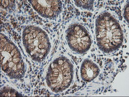 UBE2G2 Antibody in Immunohistochemistry (Paraffin) (IHC (P))