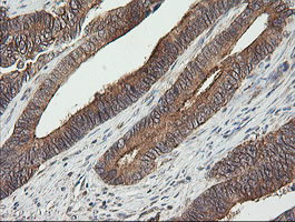 UBE2G2 Antibody in Immunohistochemistry (Paraffin) (IHC (P))