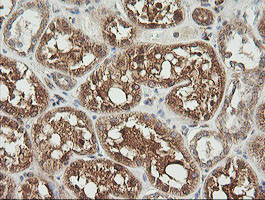 UBE2G2 Antibody in Immunohistochemistry (Paraffin) (IHC (P))