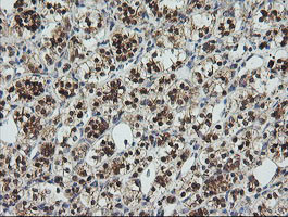 UBE2G2 Antibody in Immunohistochemistry (Paraffin) (IHC (P))