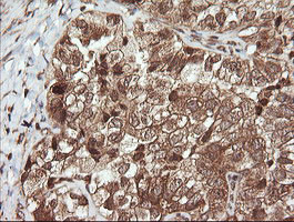 UBE2G2 Antibody in Immunohistochemistry (Paraffin) (IHC (P))