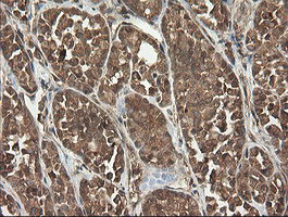 UBE2G2 Antibody in Immunohistochemistry (Paraffin) (IHC (P))