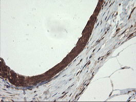 UBE2G2 Antibody in Immunohistochemistry (Paraffin) (IHC (P))