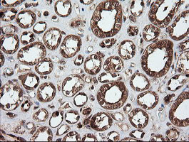 UBE2G2 Antibody in Immunohistochemistry (Paraffin) (IHC (P))