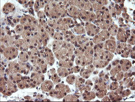 UBE2G2 Antibody in Immunohistochemistry (Paraffin) (IHC (P))