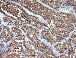 UBE2G2 Antibody in Immunohistochemistry (Paraffin) (IHC (P))