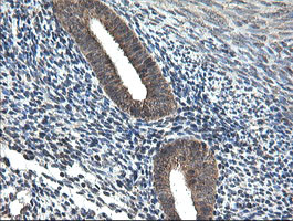 UBE2G2 Antibody in Immunohistochemistry (Paraffin) (IHC (P))