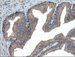 UBE2G2 Antibody in Immunohistochemistry (Paraffin) (IHC (P))