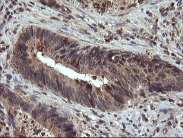 UBE2G2 Antibody in Immunohistochemistry (Paraffin) (IHC (P))