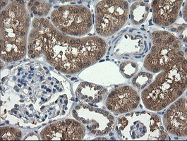 UBE2G2 Antibody in Immunohistochemistry (Paraffin) (IHC (P))