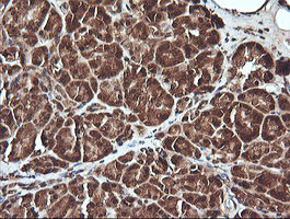 UBE2G2 Antibody in Immunohistochemistry (Paraffin) (IHC (P))