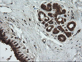 UBE2G2 Antibody in Immunohistochemistry (Paraffin) (IHC (P))