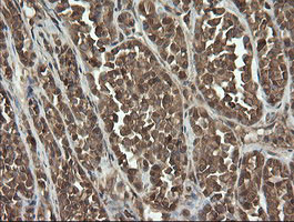 UBE2G2 Antibody in Immunohistochemistry (Paraffin) (IHC (P))