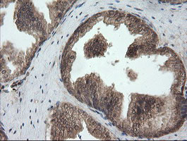 UBE2G2 Antibody in Immunohistochemistry (Paraffin) (IHC (P))