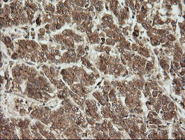 UBE2G2 Antibody in Immunohistochemistry (Paraffin) (IHC (P))