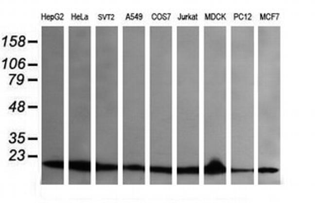 UBE2G2 Antibody in Western Blot (WB)