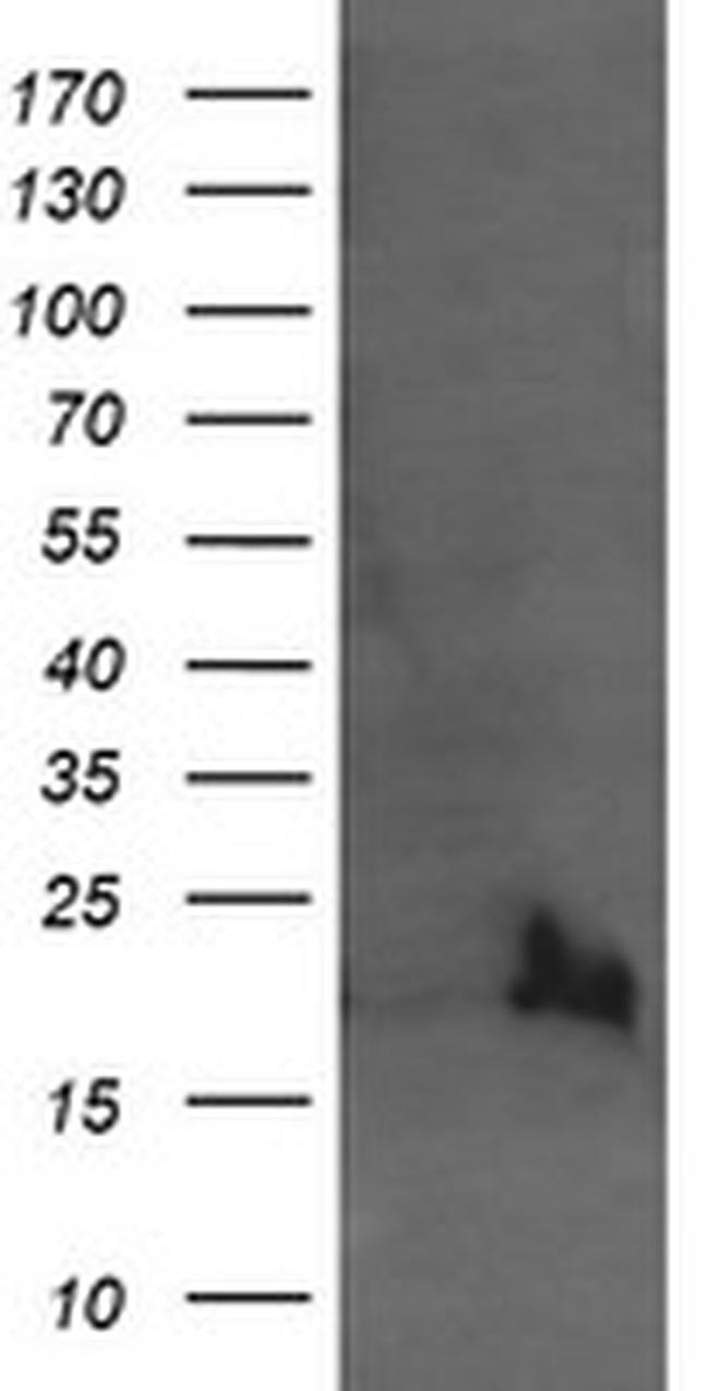 UBE2G2 Antibody in Western Blot (WB)