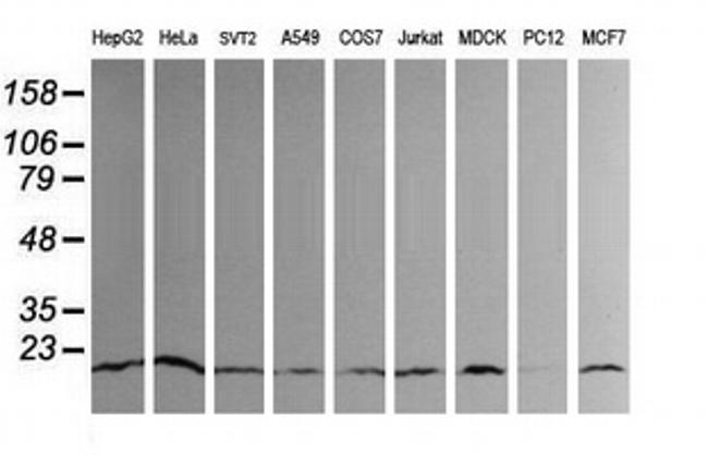 UBE2G2 Antibody in Western Blot (WB)