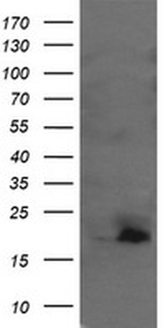 UBE2G2 Antibody in Western Blot (WB)