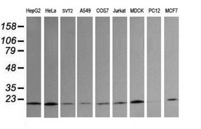 UBE2G2 Antibody in Western Blot (WB)