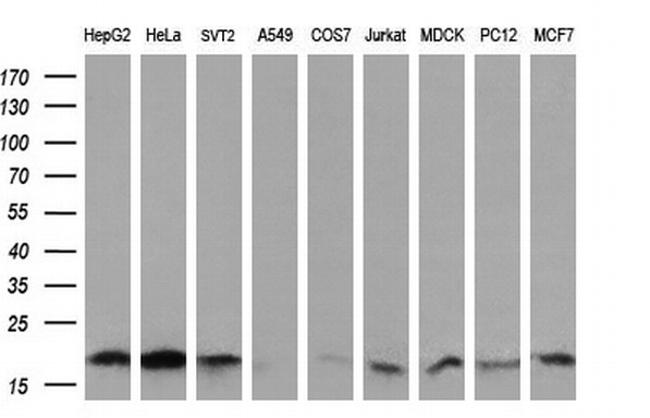 UBE2G2 Antibody in Western Blot (WB)