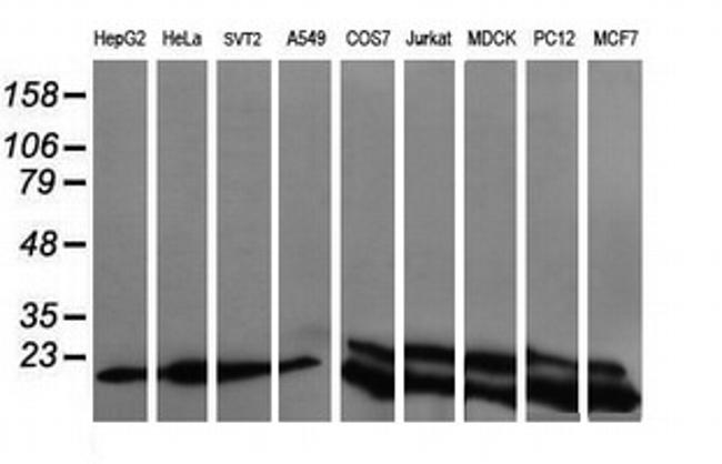 UBE2G2 Antibody in Western Blot (WB)