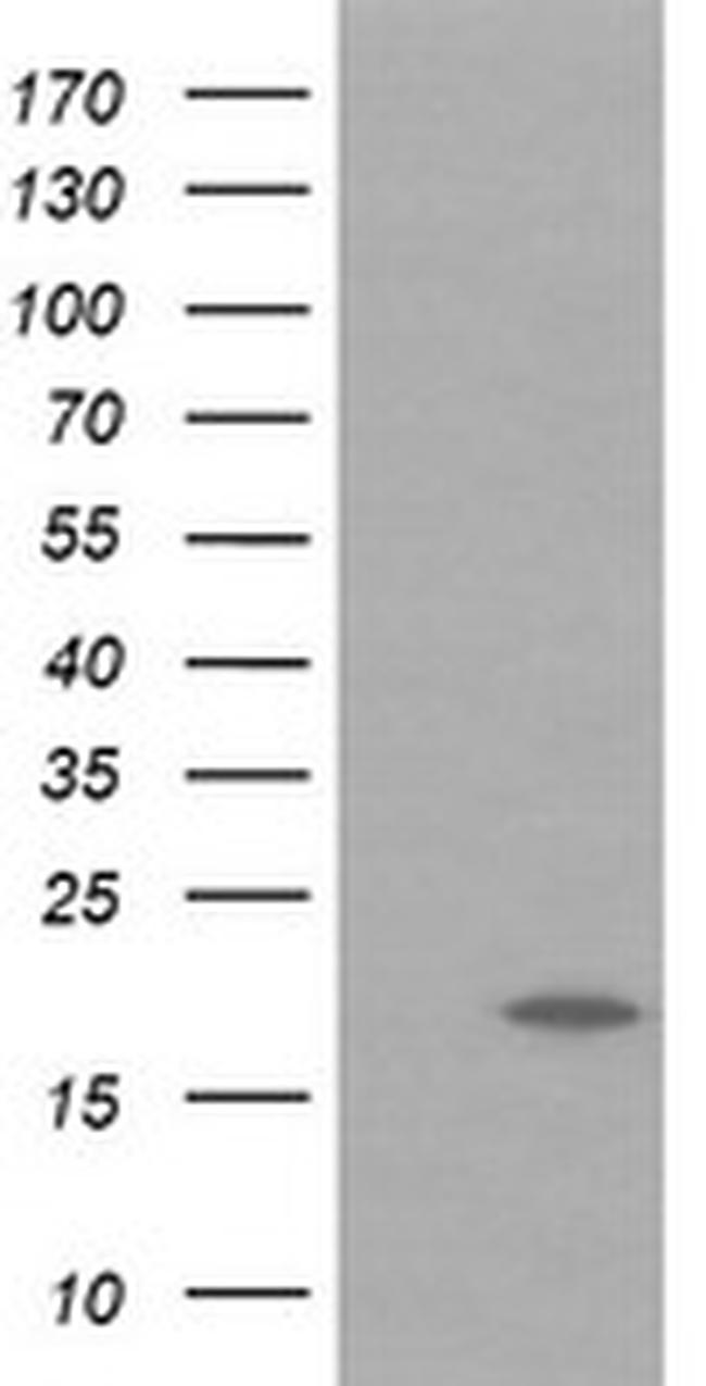 UBE2G2 Antibody in Western Blot (WB)