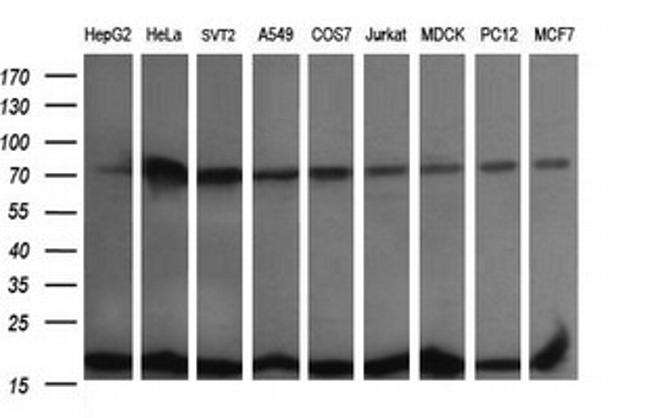 UBE2G2 Antibody in Western Blot (WB)