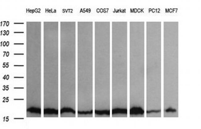 UBE2G2 Antibody in Western Blot (WB)