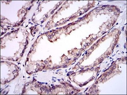 UBC9 Antibody in Immunohistochemistry (Paraffin) (IHC (P))