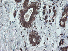 UBE2J1 Antibody in Immunohistochemistry (Paraffin) (IHC (P))