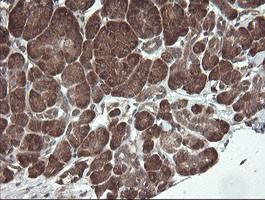 UBE2J1 Antibody in Immunohistochemistry (Paraffin) (IHC (P))