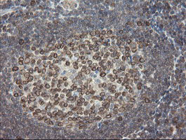 UBE2J1 Antibody in Immunohistochemistry (Paraffin) (IHC (P))