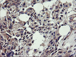 UBE2J1 Antibody in Immunohistochemistry (Paraffin) (IHC (P))