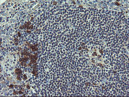 UBE2J1 Antibody in Immunohistochemistry (Paraffin) (IHC (P))