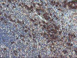 UBE2J1 Antibody in Immunohistochemistry (Paraffin) (IHC (P))