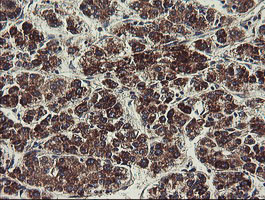 UBE2J1 Antibody in Immunohistochemistry (Paraffin) (IHC (P))