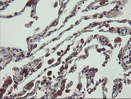 UBE2J1 Antibody in Immunohistochemistry (Paraffin) (IHC (P))